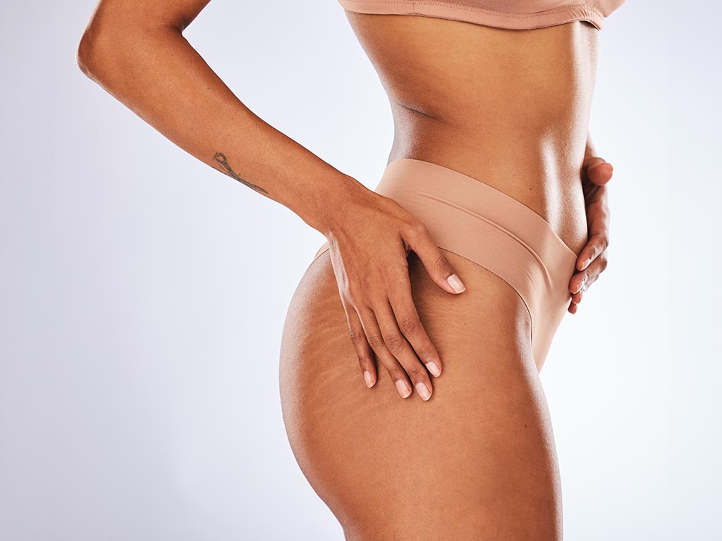 Woman, stretch marks and underwear in studio for beauty, dermatology spa and skincare wellness. Female model, cellulite and body waist for cosmetic diet, aesthetic liposuction and mockup background.